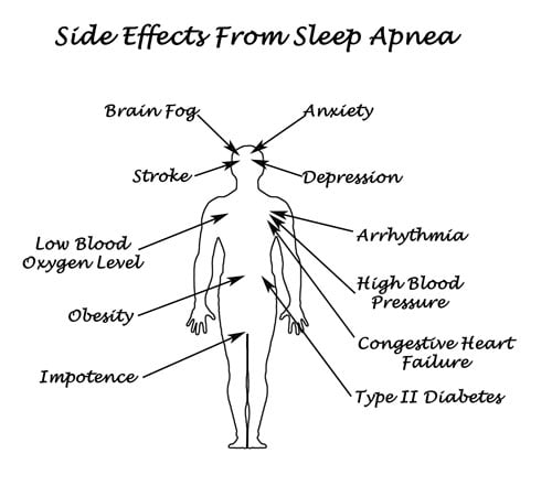 Diagram of body showing possible side effects of sleep apnea