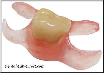 1 Tooth Partial Denture: The Ultimate Solution to a Missing Tooth